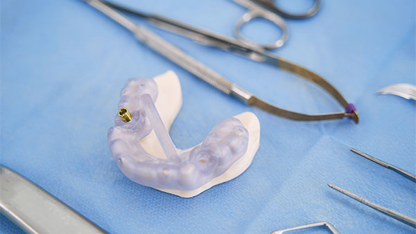 implantes dentarios campinas